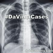 Podcast #DaVinciCases